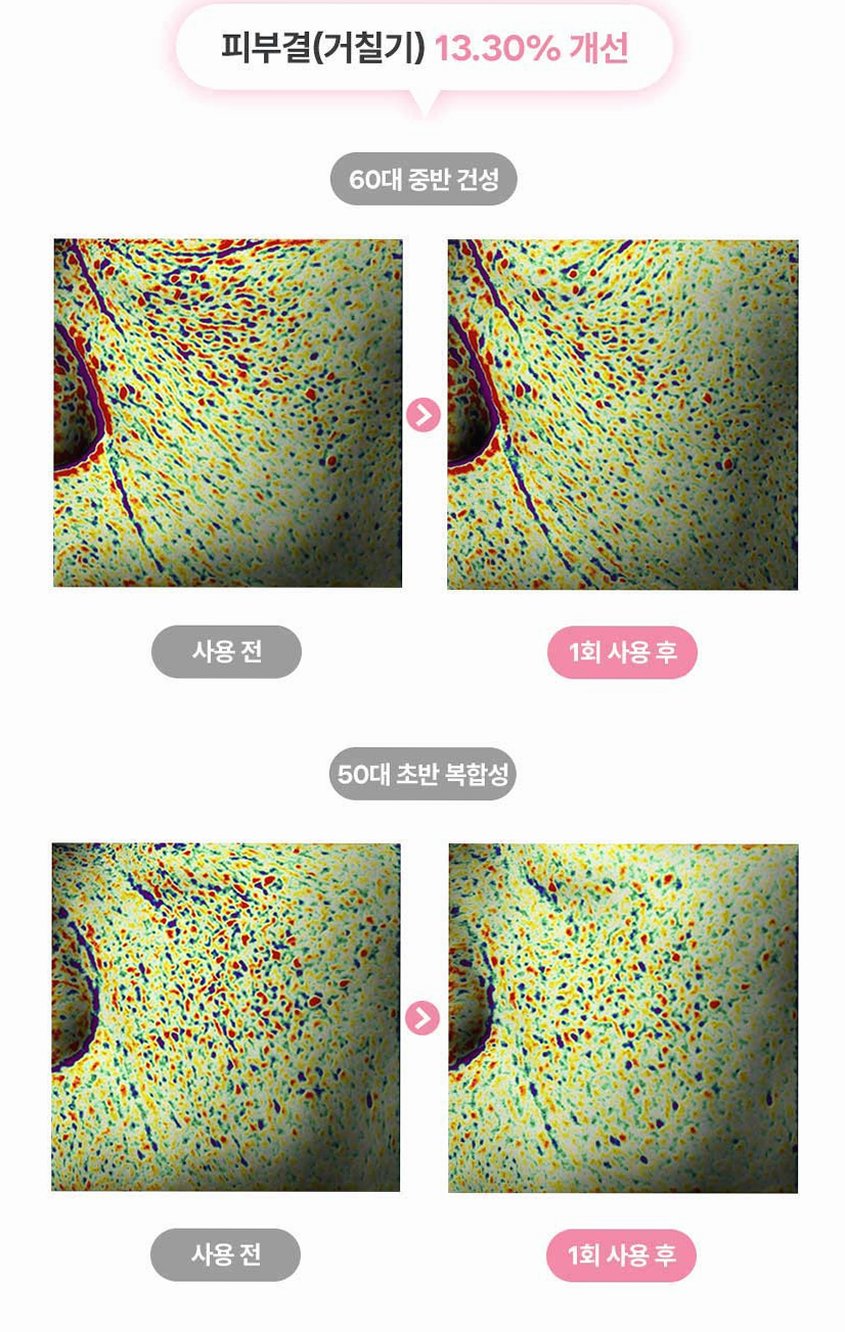 펄리 엑소좀 피부과재생크림 수분 보습 시카 히알루론산 물광크림 40ml, 1개